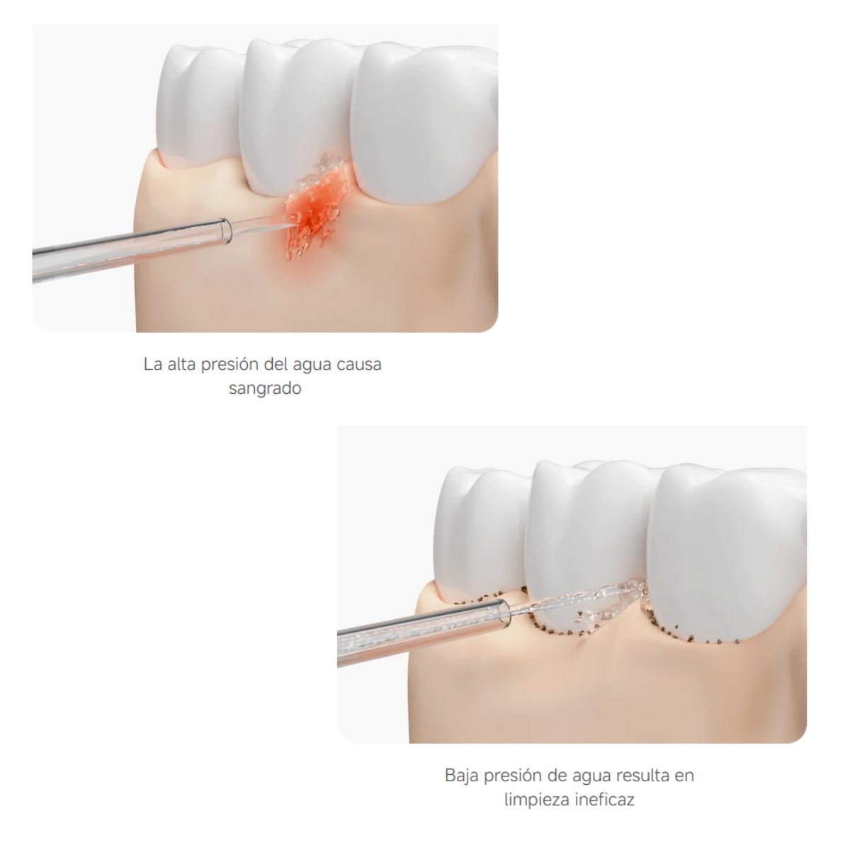 Xiaomi Irrigador Dental Water Flosser 2 IPX7 200ml
