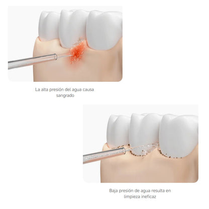 Xiaomi Irrigador Dental Water Flosser 2 IPX7 200ml